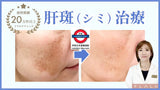 ちふれ 日本 chifure 藥用美白 淡斑去紋精華クリーム
