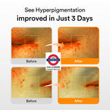 韓國 ABIB Glutathiosome Dark Spot Serum Vita Drop 高純度穀胱甘肽淡斑亮白精華50ml