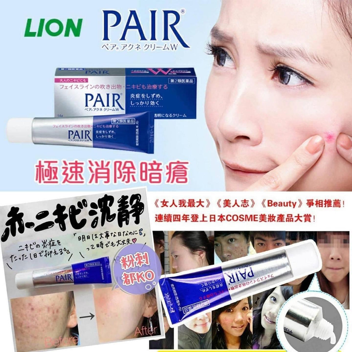 獅王Pair Acne藥用暗瘡膏24g – 伊家日本直購通販 iika Store